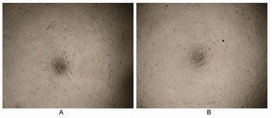 Human IGF1 protein, His tag (active). GTX00085-pro