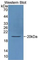Human IL10 protein, His tag (active). GTX00086-pro