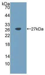 Human IL11 protein, His tag (active). GTX00087-pro