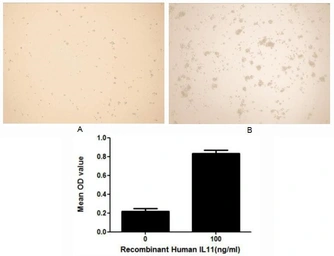 Human IL11 protein, His tag (active). GTX00087-pro