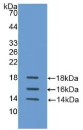 Human IL15 protein, His tag (active). GTX00088-pro