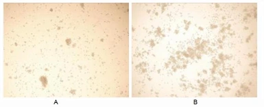 Human IL15 protein, His tag (active). GTX00088-pro