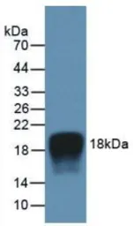 Human IL2 protein, His tag (active). GTX00092-pro