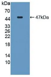 Human IL6 protein, His and GST tag (active). GTX00094-pro