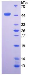 Human IL6 protein, His and GST tag (active). GTX00094-pro