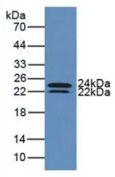 Human IL6 protein, His tag (active). GTX00095-pro