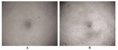 Human IL6 protein, His tag (active). GTX00095-pro