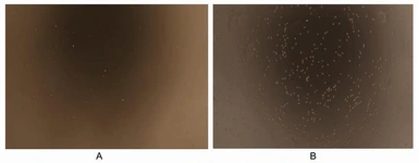 Human MIP1 alpha protein, His tag (active). GTX00096-pro