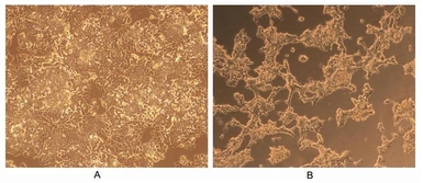 Human NGF protein, His tag (active). GTX00097-pro