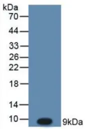Human SDF1 protein, His tag (active). GTX00098-pro