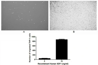 Human SDF1 protein, His tag (active). GTX00098-pro