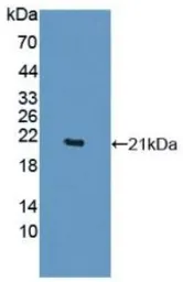 Human TNF alpha protein, His tag (active). GTX00102-pro