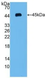 Human VEGFC protein, His tag (active). GTX00104-pro