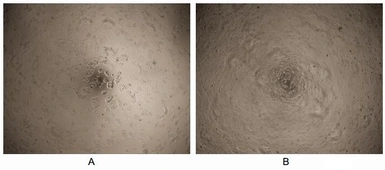 Human GAS6 protein, His tag (active). GTX00106-pro