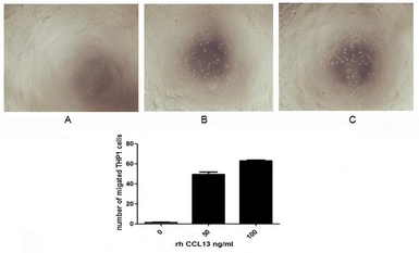 Human MCP4 protein, His tag (active). GTX00107-pro