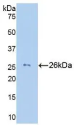 Human Granzyme M protein, His tag (active). GTX00112-pro