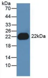 Human IL1 beta protein, His tag (active). GTX00115-pro