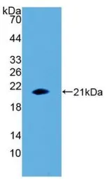 Human IL1 beta protein, His tag (active). GTX00116-pro