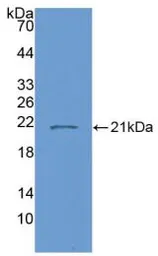 Human IL7 protein, His tag (active). GTX00118-pro