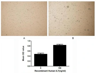 Human IL7 protein, His tag (active). GTX00118-pro