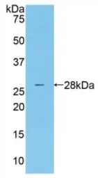 Human MASP2 protein, His tag. GTX00122-pro