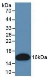 Human CD137 protein, His tag. GTX00128-pro