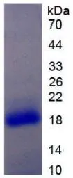 Human IL17 Receptor alpha protein, His tag. GTX00132-pro