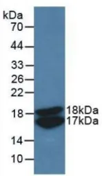 Human VEGF121 protein, His tag (active). GTX00136-pro