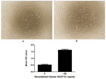 Human VEGF121 protein, His tag (active). GTX00136-pro