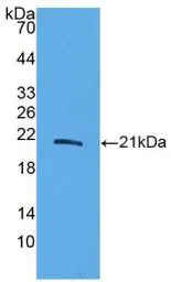 Human IL20 protein, His tag (active). GTX00137-pro