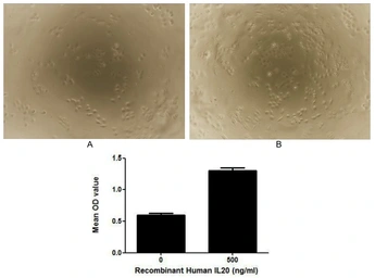 Human IL20 protein, His tag (active). GTX00137-pro