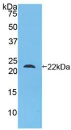 Human ARMET protein, His tag (active). GTX00139-pro