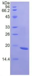 Human FNDC5 protein, His tag (active). GTX00149-pro