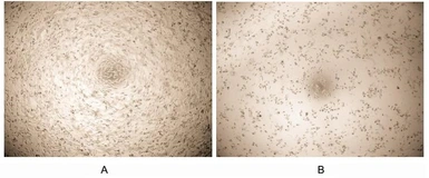 Human FNDC5 protein, His tag (active). GTX00149-pro