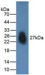 Human FNDC5 protein, His tag (active). GTX00150-pro