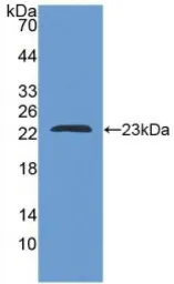 Human APRT protein, His tag. GTX00157-pro