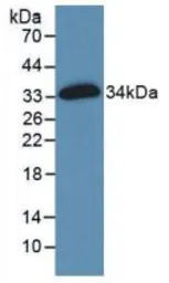 Human Fibronectin protein, His tag. GTX00165-pro