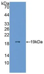 Human ESM1 protein, His tag. GTX00169-pro