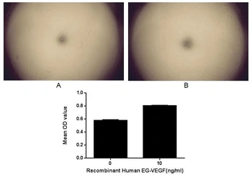 Human EG-VEGF protein, GST tag (active). GTX00186-pro