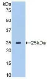 Human MMP13 protein, His tag (active). GTX00191-pro