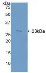 Human Galectin 3 protein, His tag (active). GTX00195-pro
