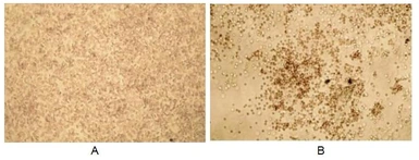 Human Galectin 3 protein, His tag (active). GTX00195-pro