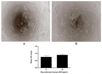Human MIF protein, His tag (active). GTX00196-pro