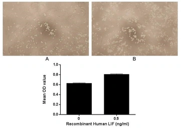 Human LIF protein, His tag (active). GTX00201-pro