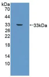 Human PDGF beta protein, His tag (active). GTX00204-pro