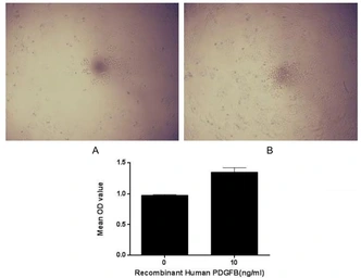 Human PDGF beta protein, His tag (active). GTX00204-pro