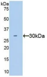 Human HGF protein, His tag (active). GTX00206-pro