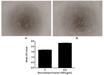Human HGF protein, His tag (active). GTX00206-pro