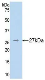 Human NG2 protein, His tag. GTX00208-pro