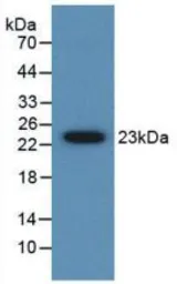 Human Gremlin 1 protein, His tag (active). GTX00209-pro